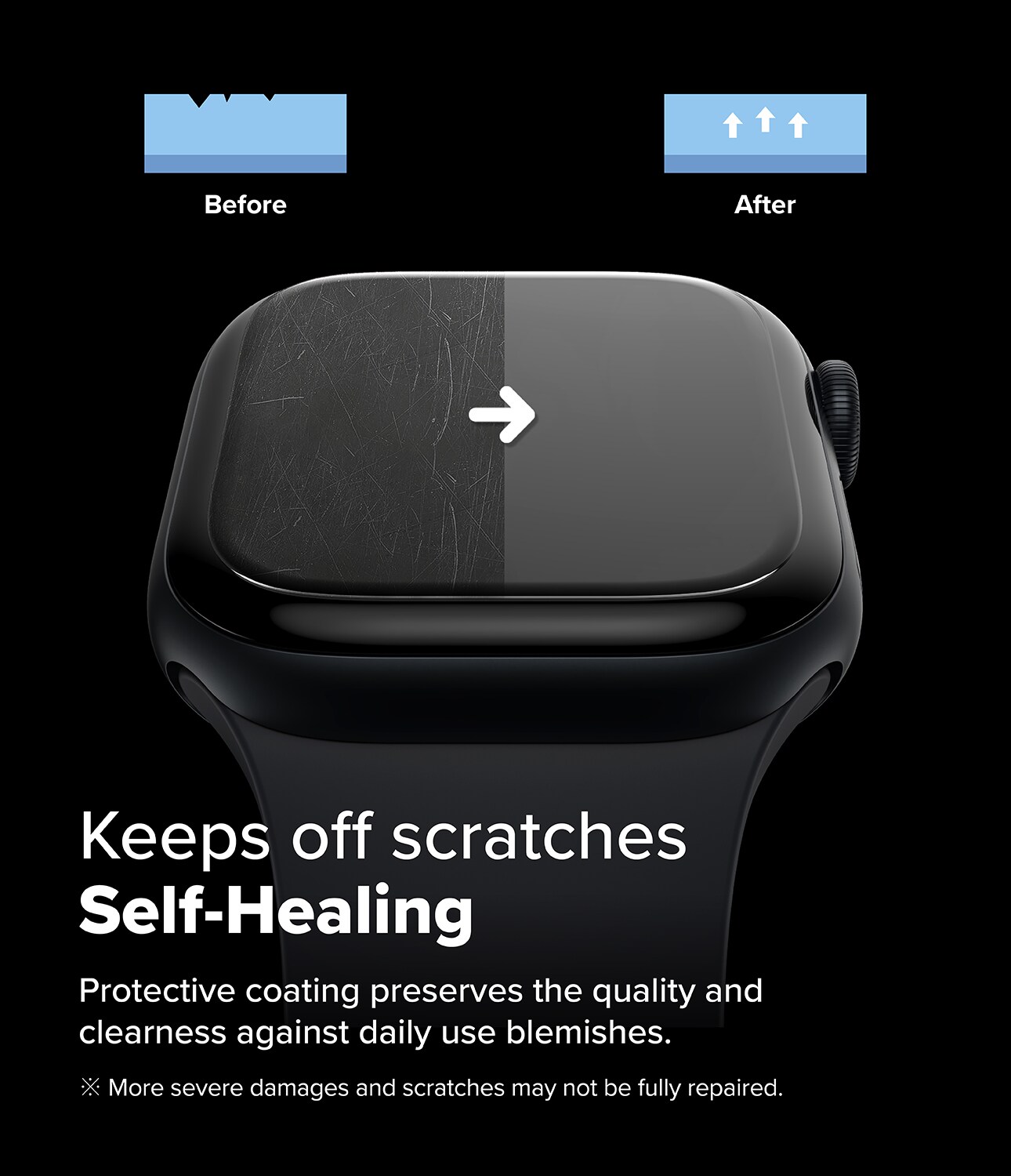 Apple Watch Series 10 42mm Skærmbeskytter beskyttelsesfilm - Dual Easy (3-pak)